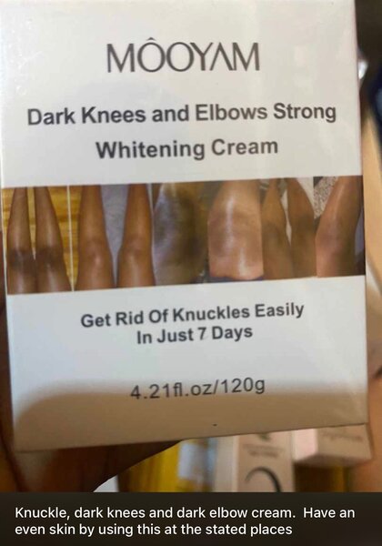 Dark knees, elbow and knuckles whitening cream