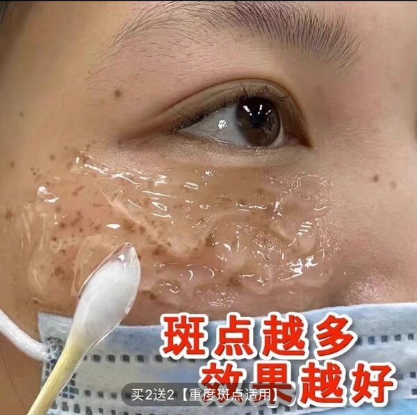 сыворотка беттеги так сепкил кетируу учун