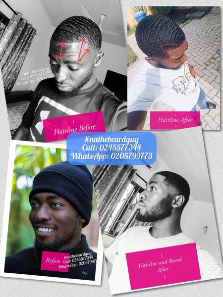 For Beard growth & Baldness