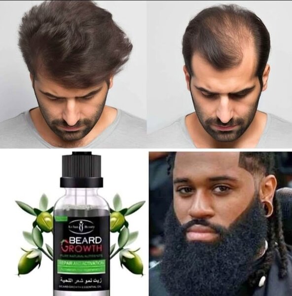 Fait poussé les cheveux, la Barbe en 3 semaine