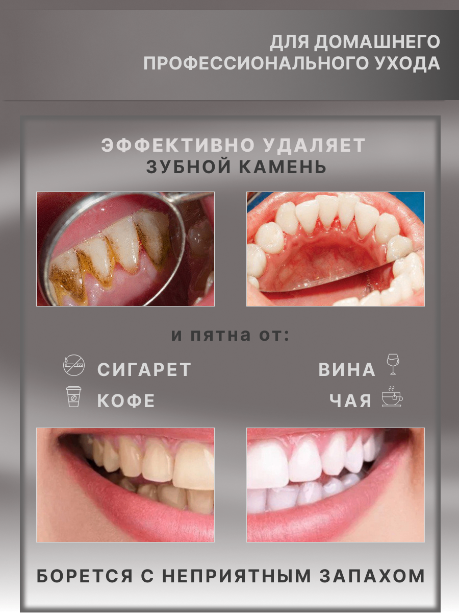 Электрическая Зубная Щетка