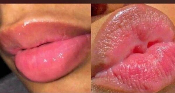 Baume à lèvres hydratant