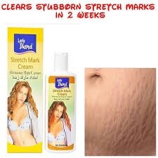 LADY DIANA STRETCH MARKS CREAM