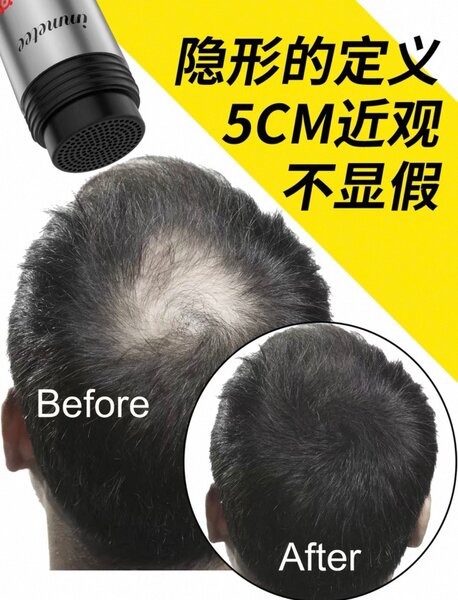 Immetee Fibres Capillaires