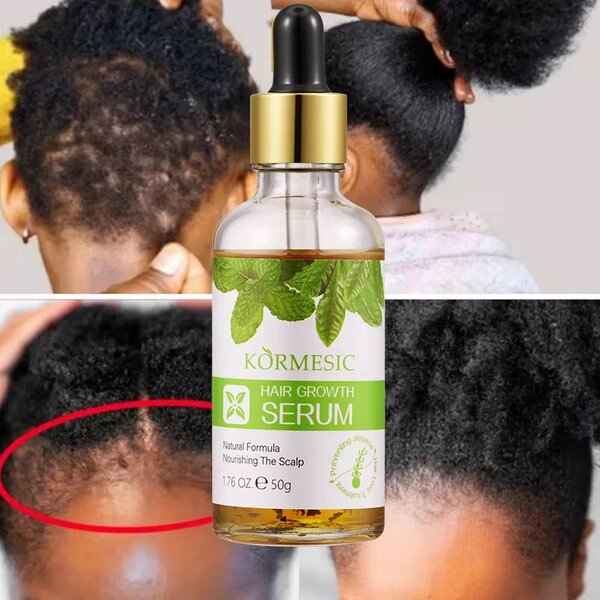 Kormesic Serum de Croissance des Cheveux