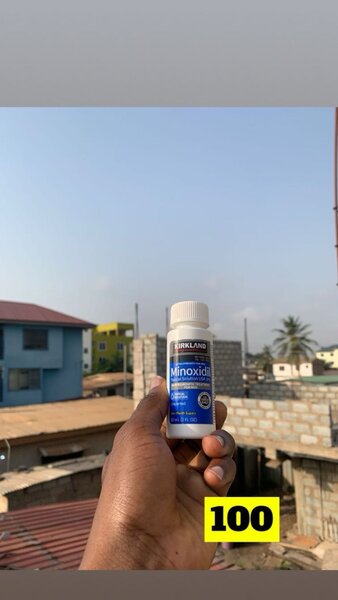 Kirkland minoxidil oil