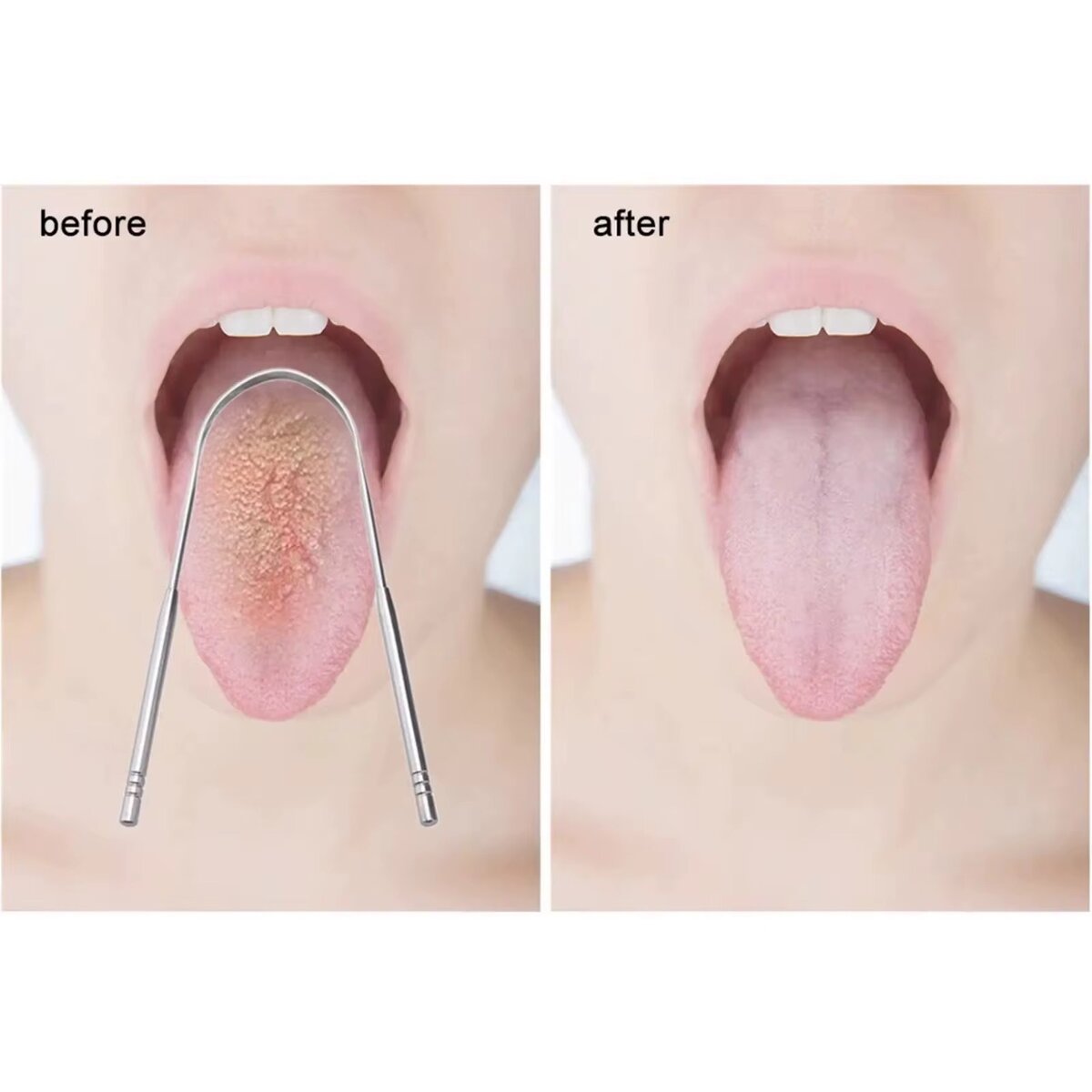 Gratte-langue en acier inoxydable