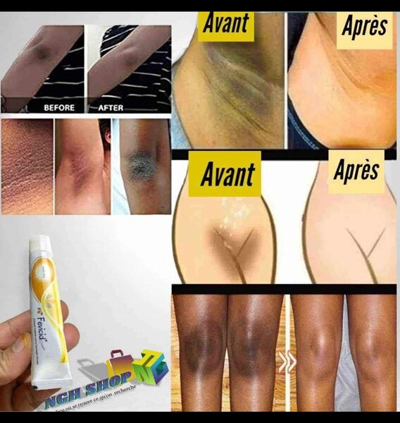 Fevicid Crème Antiseptique