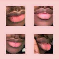Lèvre rose