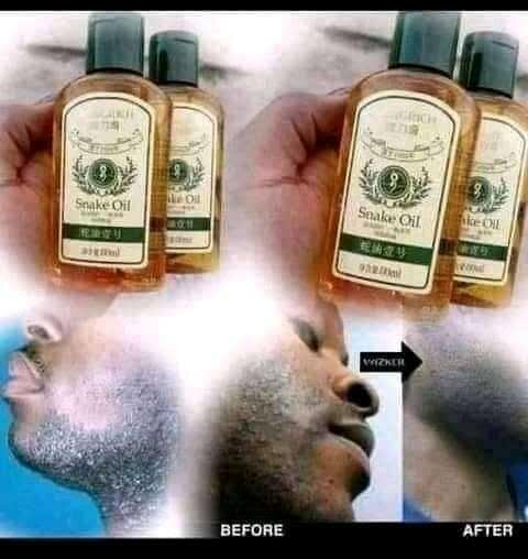 Huile de Serpent Cheveux et Peau