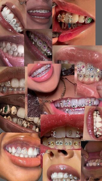 Tooth  gems