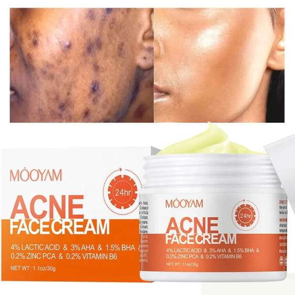 Crème Anti-Acné MOOYAM