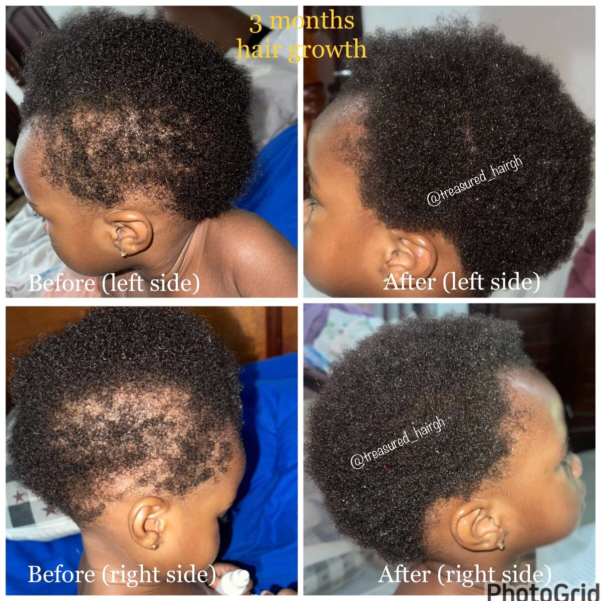 Ayurvedic hair growth oil