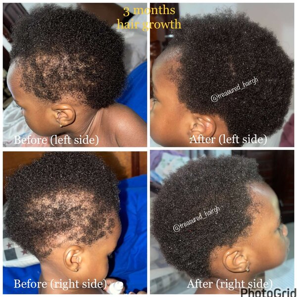 Ayurvedic hair growth oil