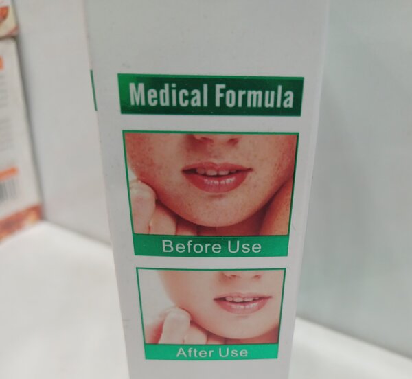 Anti-Freckle Whitening Serum