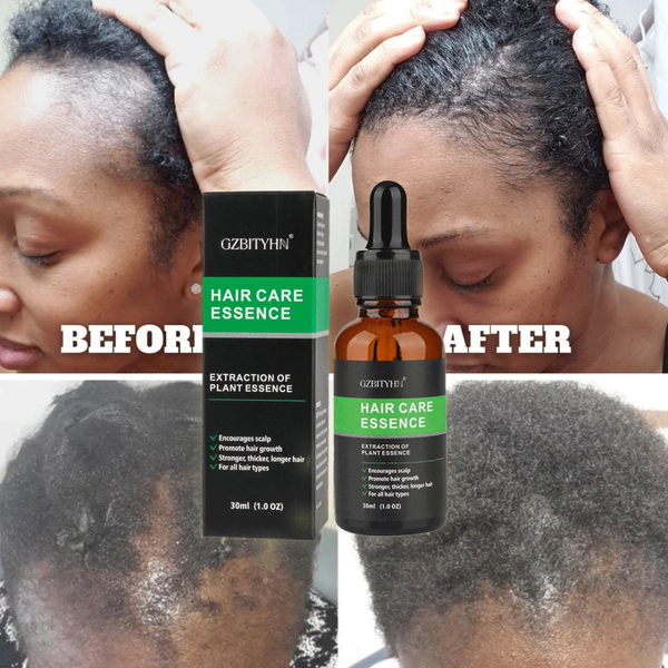 Essence de soin cheveux GZBTYHN