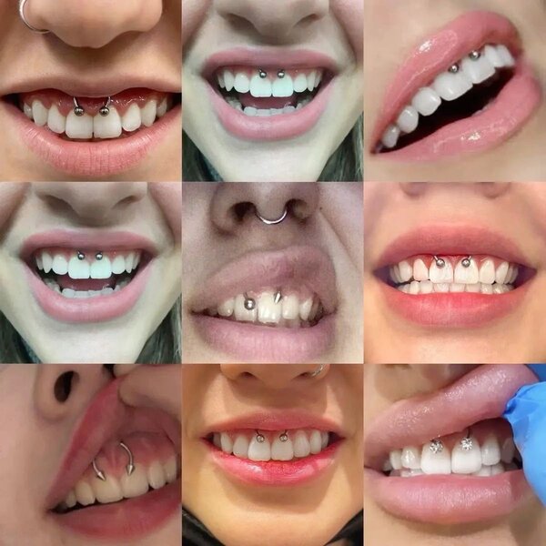 Piercing dentaire et corps en acier inoxydable