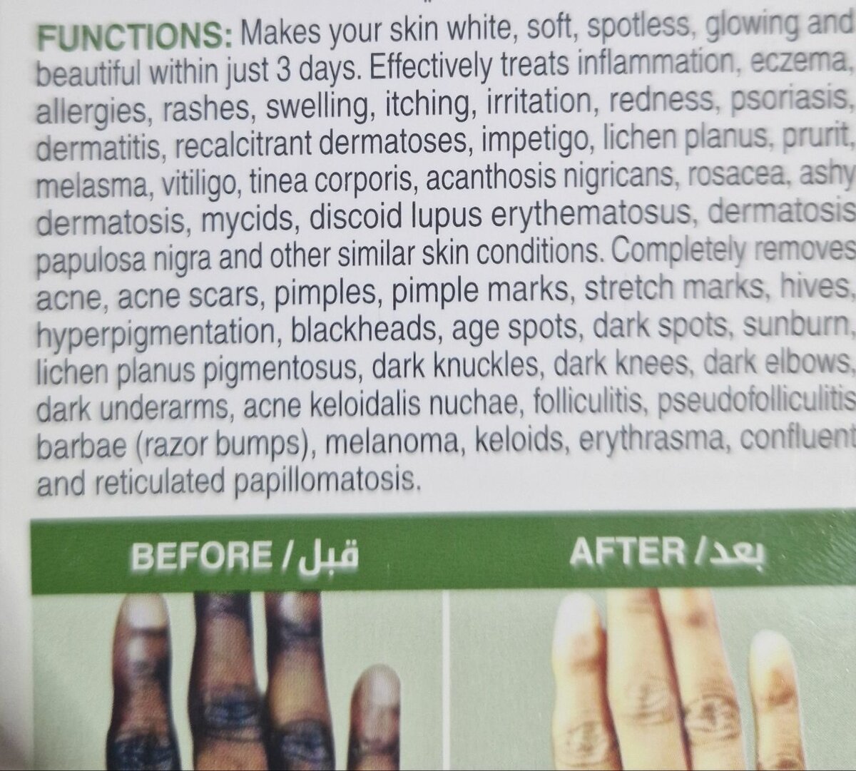 Crème contre les tâches