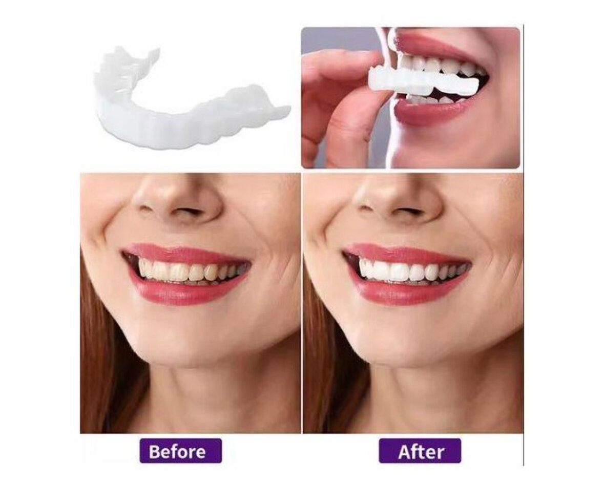 Prothèses Dentaires Esthétiques