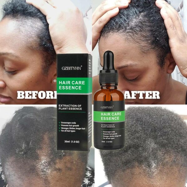 Essence soin cheveux GZBTYHN 30ml