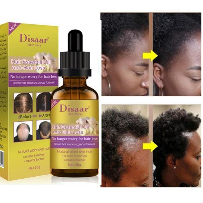 Huile Anti-Chute Cheveux Disaar