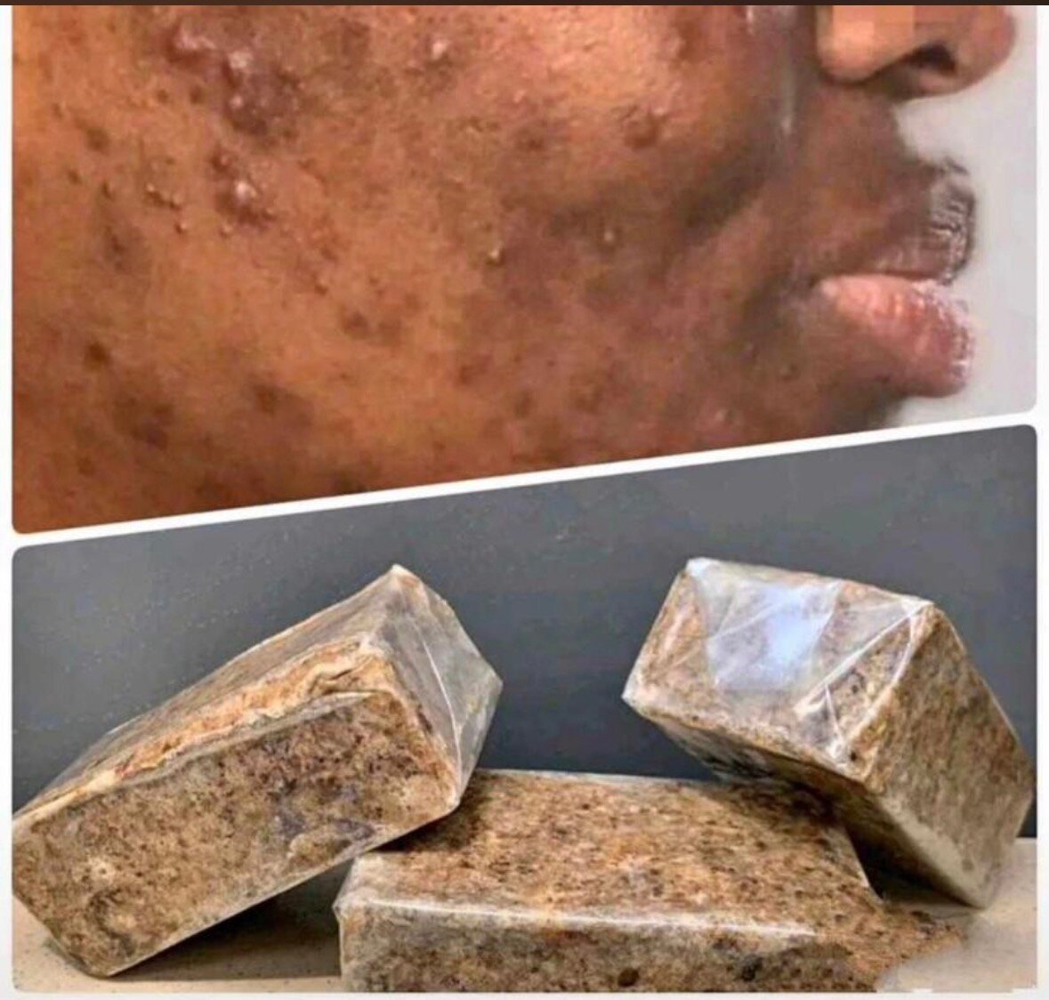 Savon anti-imperfections naturel