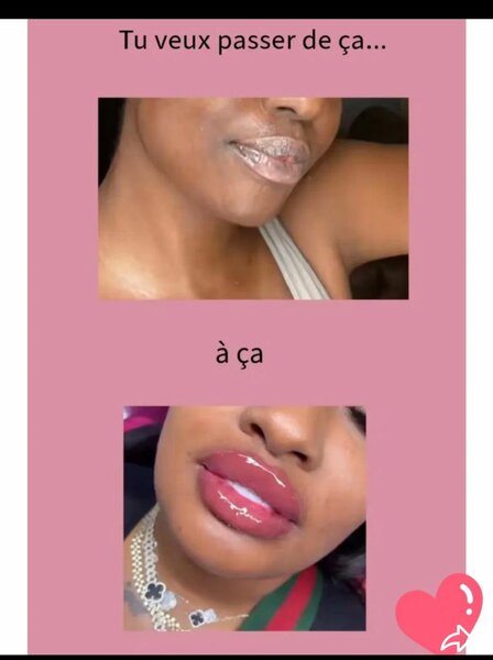 Gloss Lèvres Volumateur